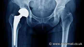 Poisoned by a hip replacement: Fears thousands may be at risk as woman claims implant op wrecked her life