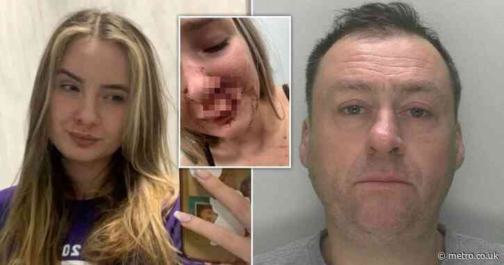 Girl, 19, had her face ‘bitten off’ by stranger on bus in front of passengers