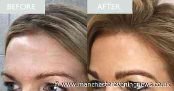 'After one application I noticed a huge difference': Award-winning retinol beauty buffs 'swear by' for forehead lines