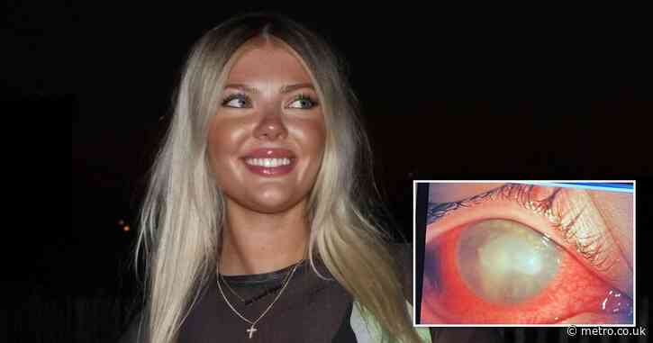 Woman goes blind after contact lens mistake meant parasites burrowed in her eye