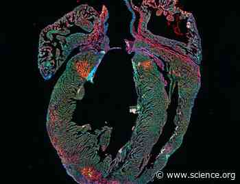 The de novo purine synthesis enzyme Adssl1 promotes cardiomyocyte proliferation and cardiac regeneration | Science Signaling