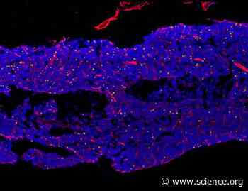 CXCR4 signaling determines the fate of hematopoietic multipotent progenitors by stimulating mTOR activity and mitochondrial metabolism | Science Signaling