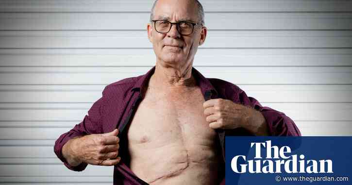 ‘I couldn’t believe it’: routine GP checkup reveals 2kg tumour growing in Brisbane man’s liver