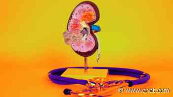 Kidney Health Made Easy: 13 Essential Foods to Protect Your Function