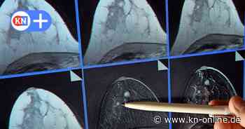 Künstliche Intelligenz soll Früherkennung von Brustkrebs in SH verbessern