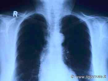 Polmonite batterica, segni e sintomi a cui fare attenzione. Le complicanze possono essere fatali