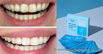 Shoppers praise teeth whitening product that 'removes stains' in time for Christmas