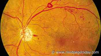 Slow Start for AI-Assisted Screening for Diabetic Retinopathy Despite Promise