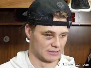 Ottawa Senators centre Tim Stutze says he's lucky his eye injury wasn't worse