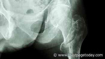 Gabapentinoids Tied to Hip Fractures in Older Adults