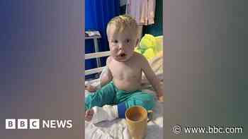 Boy, 2, 'lucky to be alive' after bully dog attack