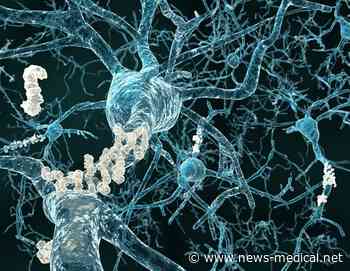 Researchers use cerebrospinal fluid to unlock pathways in Alzheimer's disease