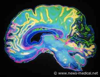 Study defines three subtypes of Chiari type-1 malformation to guide treatment