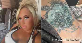 'Turkey holiday tattoo infection left me facing having my foot amputated'