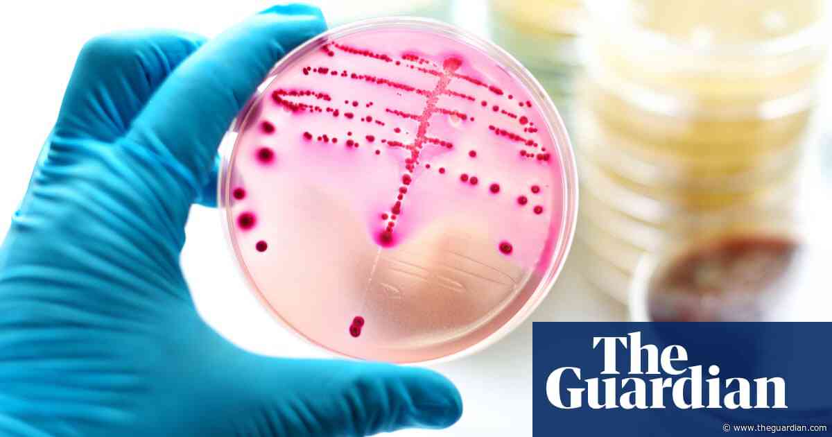 Australian women to get home self tests for chlamydia and gonorrhoea – but experts urge caution