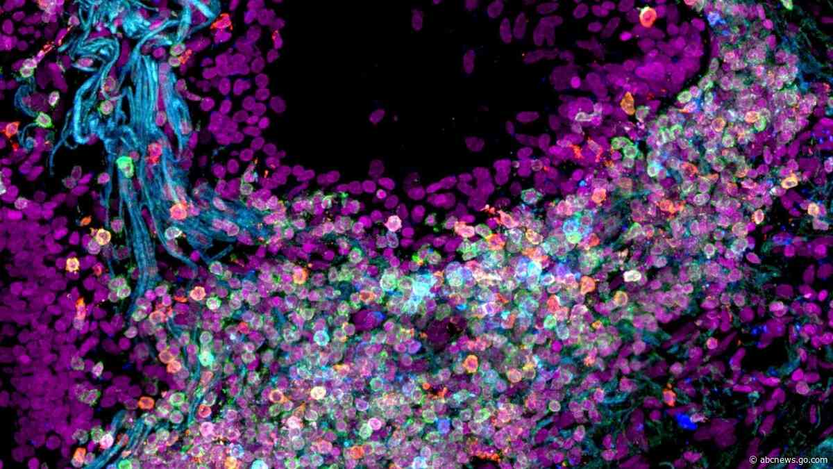 Scientists map out the human body one cell at a time