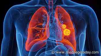 Treatment of Oligometastatic EGFR-Mutant Lung Cancer