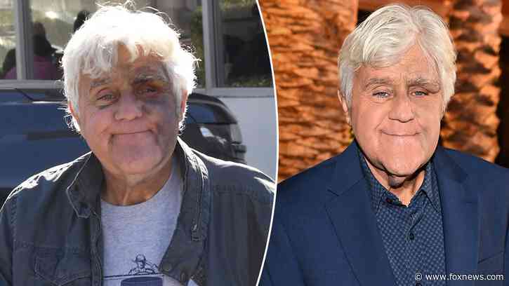 Jay Leno ‘feeling good’ despite suffering bruised face from fall