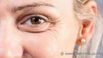 Crow's feet could be early sign of dementia as research suggests people with more wrinkles on their face are 2.5 times more likely to show cognitive decline