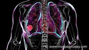 What Could This Exploratory 5-Year Survival Data in Adjuvant NSCLC Treatment Mean?