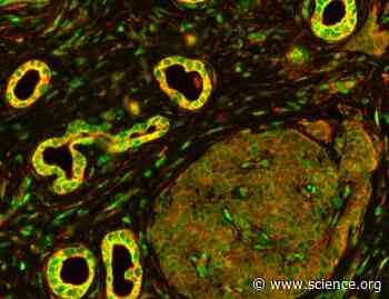 AXL-TBK1 driven AKT3 activation promotes metastasis | Science Signaling