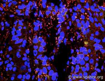 Castration-resistant prostate cancer is resensitized to androgen deprivation by autophagy-dependent apoptosis induced by blocking SKP2 | Science Signaling