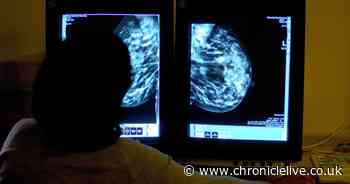 Concern over reduction in cancer screening in the UK