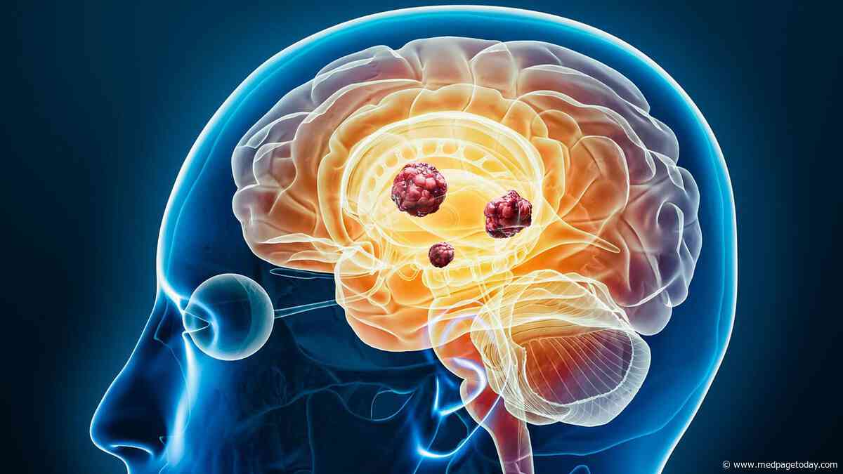 Asymptomatic Brain Metastases in EGFR-Mutant NSCLC