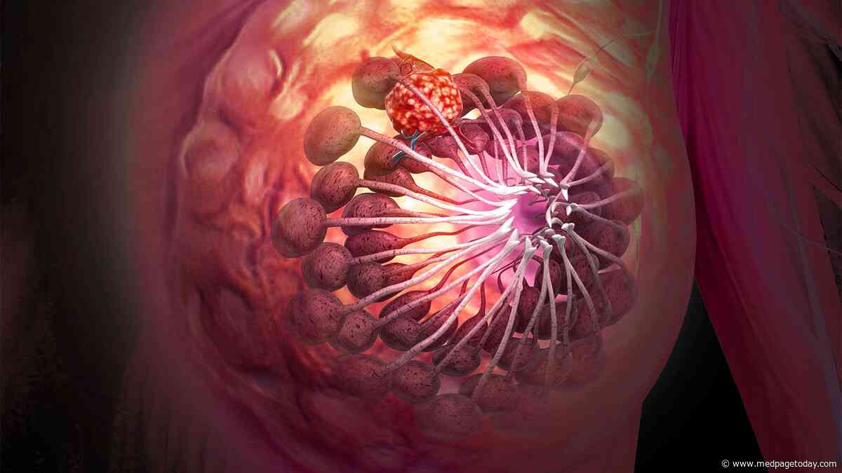 Sticking With CDK4/6 Inhibitors for Breast Cancer Wins in Post-Progression Setting