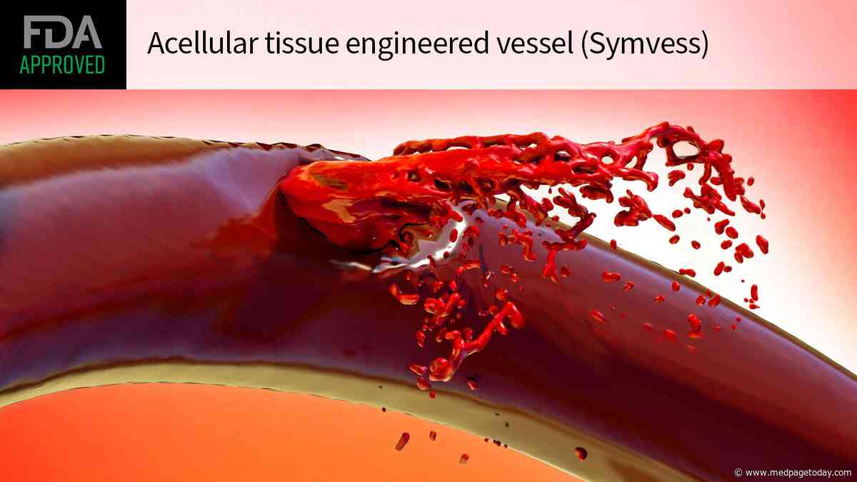 FDA OKs Bioengineered Vessel to Reduce Limb Amputations After Vascular Trauma