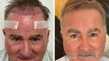 Former Sky Sports presenter Richard Keys enjoys astonishing hair transformation as he shows off progress of transplant which he had five months ago