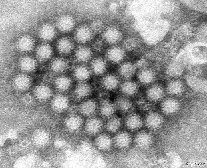 Nasty norovirus is back in full force with US cases of the stomach virus surging