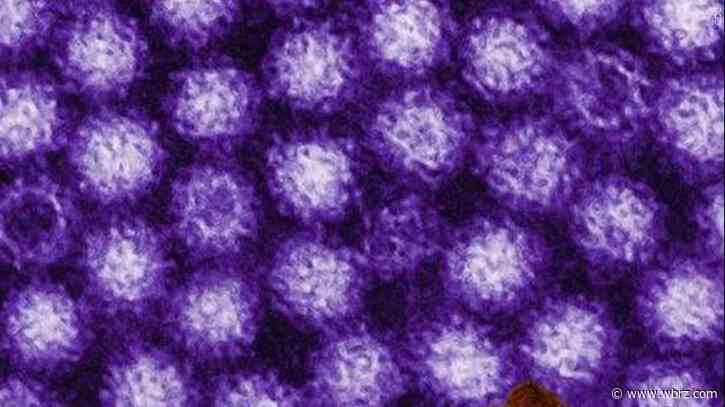 Nasty norovirus is back in full force with US cases of the stomach virus surging