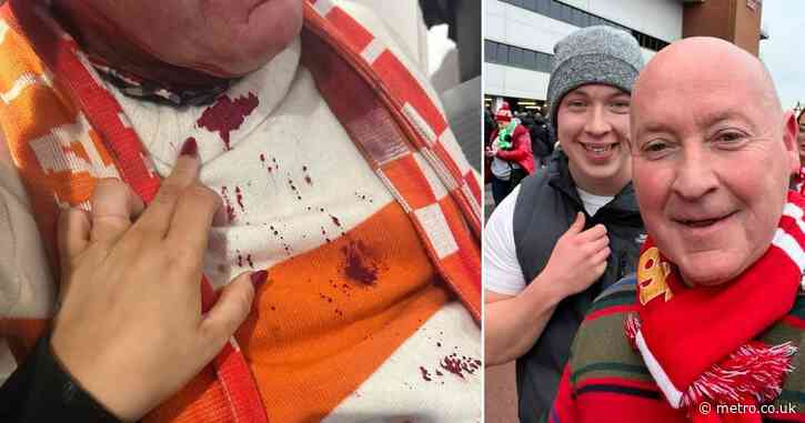 Liverpool fan’s horrific head injury after being attacked by rival supporter