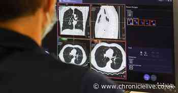 Cancer diagnosis at early stage in England reaches highest level, NHS analysis shows