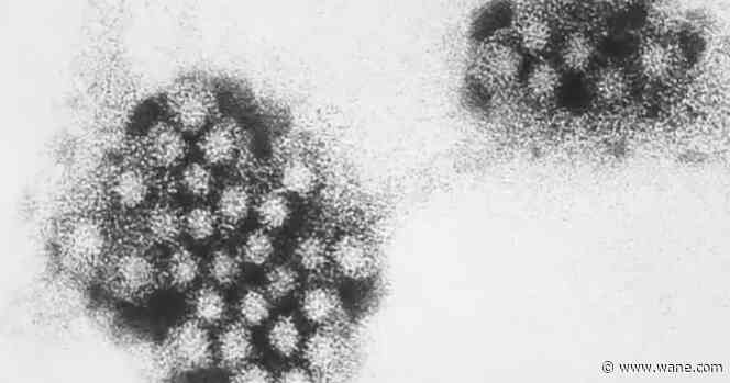 Cases of Norovirus expected to rise in 2025