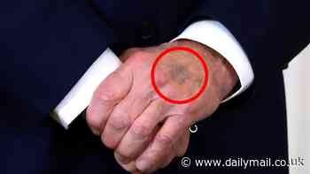 Mysterious mark appears on Biden's hand during White House appearance