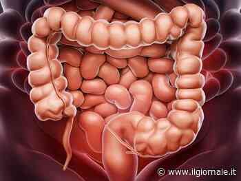 Tumore al colon-retto, quali sono i sintomi iniziali: ecco come avviene la diagnosi