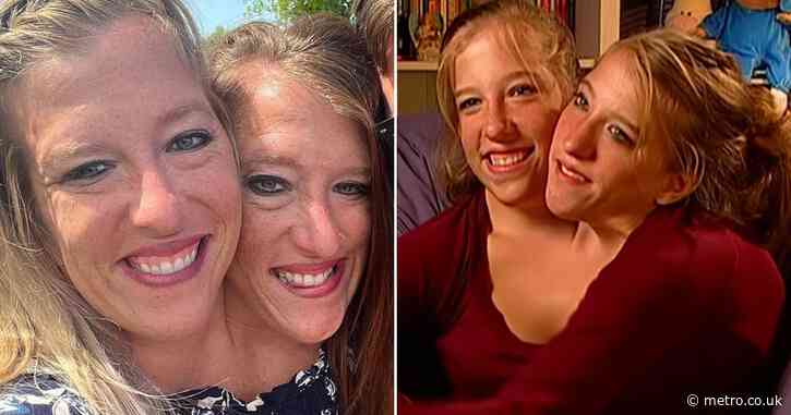 Conjoined twin sisters finally reveal how their bodies are really connected