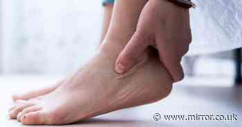 Sign in the foot that could signal heart failure, liver disease or blood clots