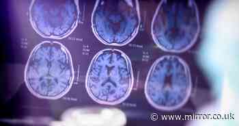 Alzheimer's risk linked to 'surprising' STI with painful symptoms, study warns