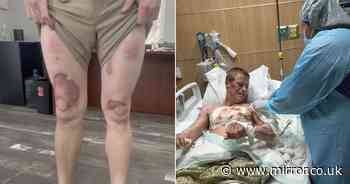 Man left with skin burned off legs after cops pin him to baking hot ground in 45C heat