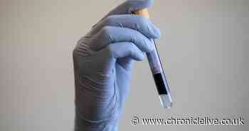 Simple blood test 'could reduce number of lung cancer deaths'