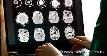 Link between head injuries and Alzheimer's-triggering viruses found by study