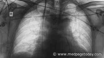 Do TNF Inhibitors Really Worsen RA-Associated Lung Disease?