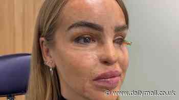 Katie Piper shares emotional health update after undergoing eye surgery: 'I've reached the end of the road'