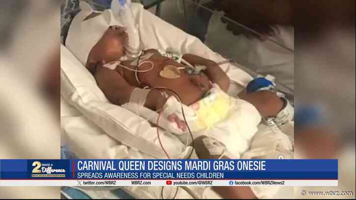 2 Make a Difference: 2-year-old who died from Crouzon Syndrome honored with Mardi Gras onesies