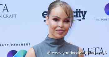 Katie Piper trialling out 'artificial eye' 16 years after acid attack