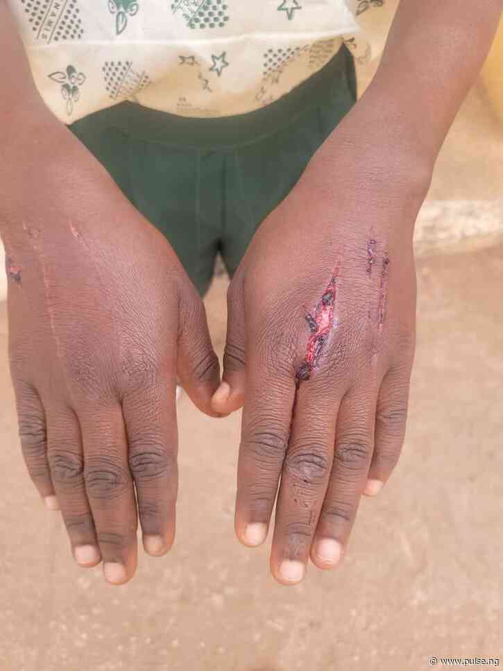 For stealing ₦600, Ogun woman injured her 10-year-old ward