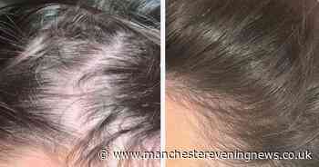 'After 5-weeks of using it her hair looked thicker, and her lashes were longer'